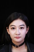 昆明吴氏嘉美白孝梅玻尿酸丰面颊怎么样？价格案例分享