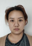 昆明卓星射频溶脂瘦脸怎么样？价格案例分享